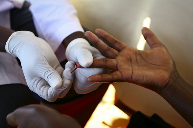 hiv