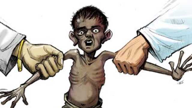 malnourished
