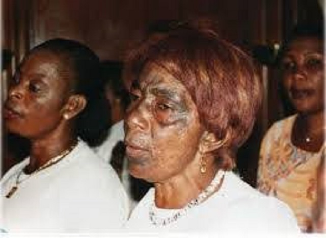 Wire picture. Your brown skin is beautiful and it is the only skin you will ever get so do not harass it. Rather, invest in moisturising essential oils like coconut and vitamin E, have a good sun protection factor sunscreen and preserve your chocolate coating